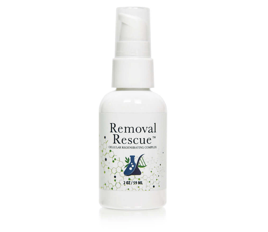 Removal Rescue - Inkbox Artistry
